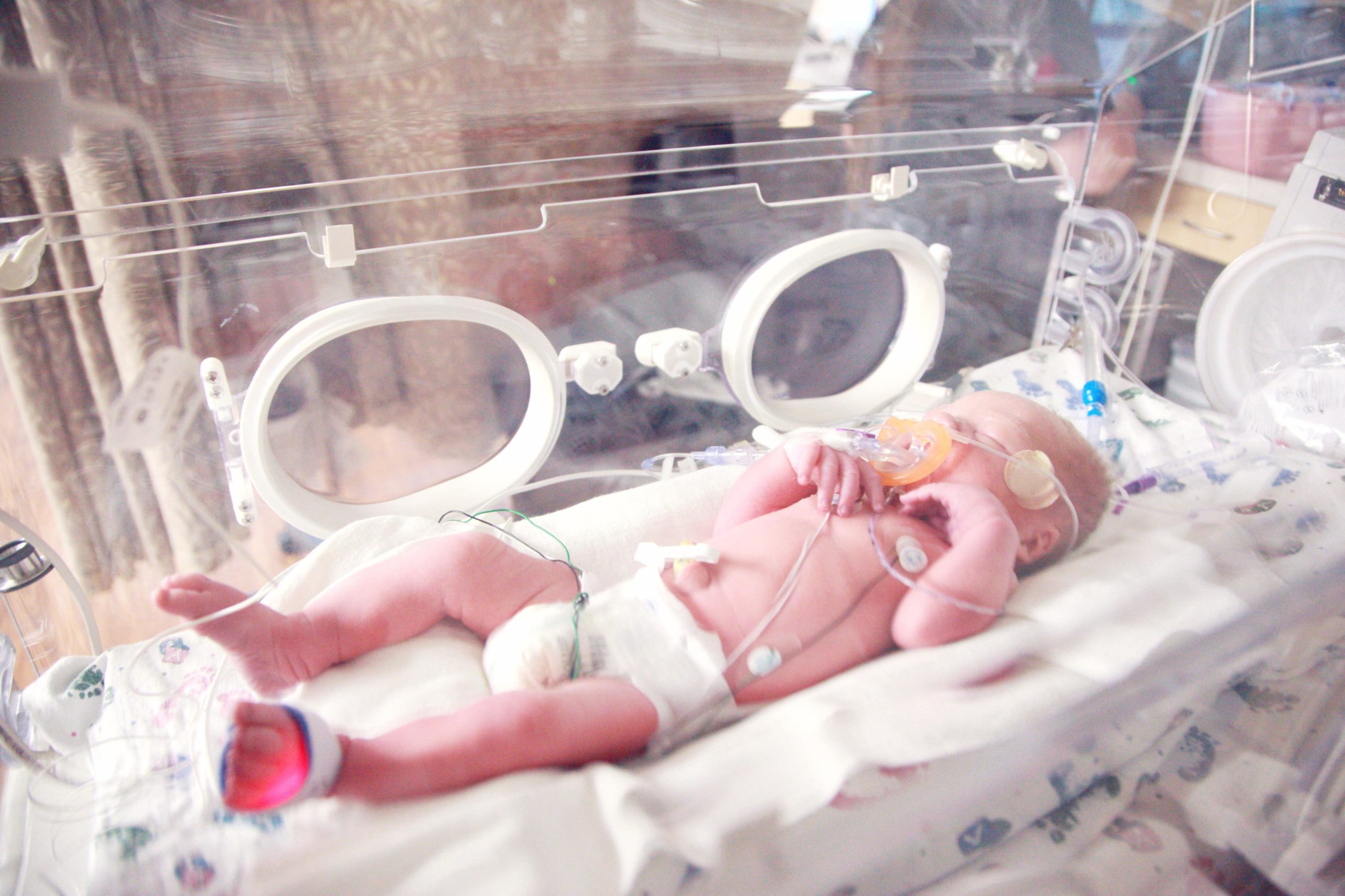 Viabilite Du Foetus Le Combat Que Nous Avons Mene Bebe Premature