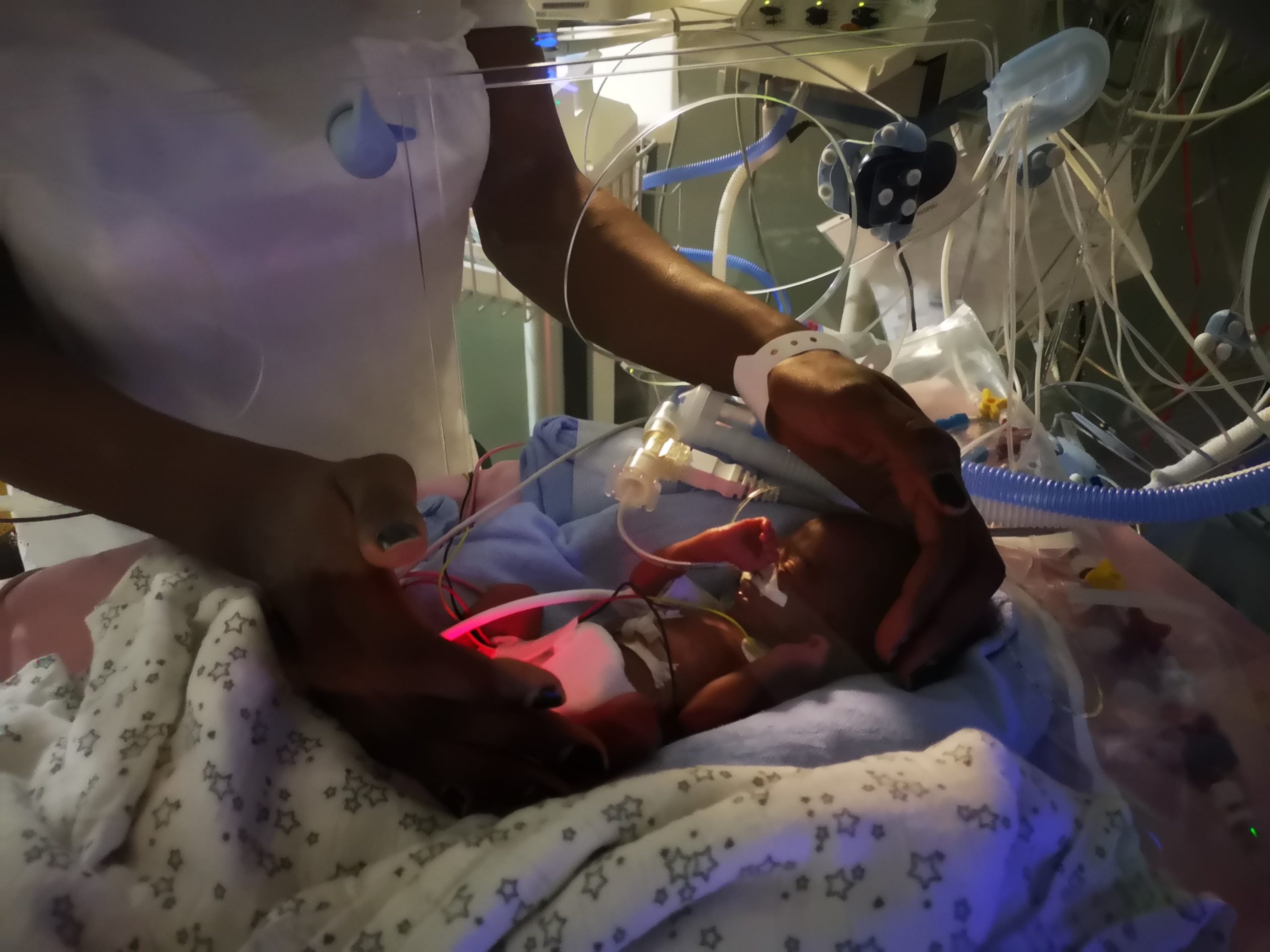 Neonatologie Recit Du Service Qui S Est Occupe De Notre Bebe Premature